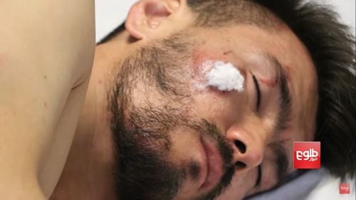 Violența împotriva jurnaliștilor în Afganistan din partea talibanilor s-a extins în ultimele zile – Reporters Sans Frontieres