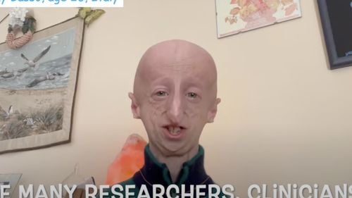 A murit omul de ştiinţă Sammy Basso, renumit pentru activitatea sa de conştientizare asupra progeriei, boală de care suferea