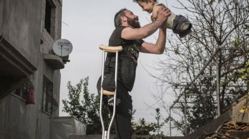 O fotografie cu un tată ridicându-şi fiul născut fără mâini şi picioare spre cer, ambii supraviețuitori ai războiului din Siria, a emoţionat Italia