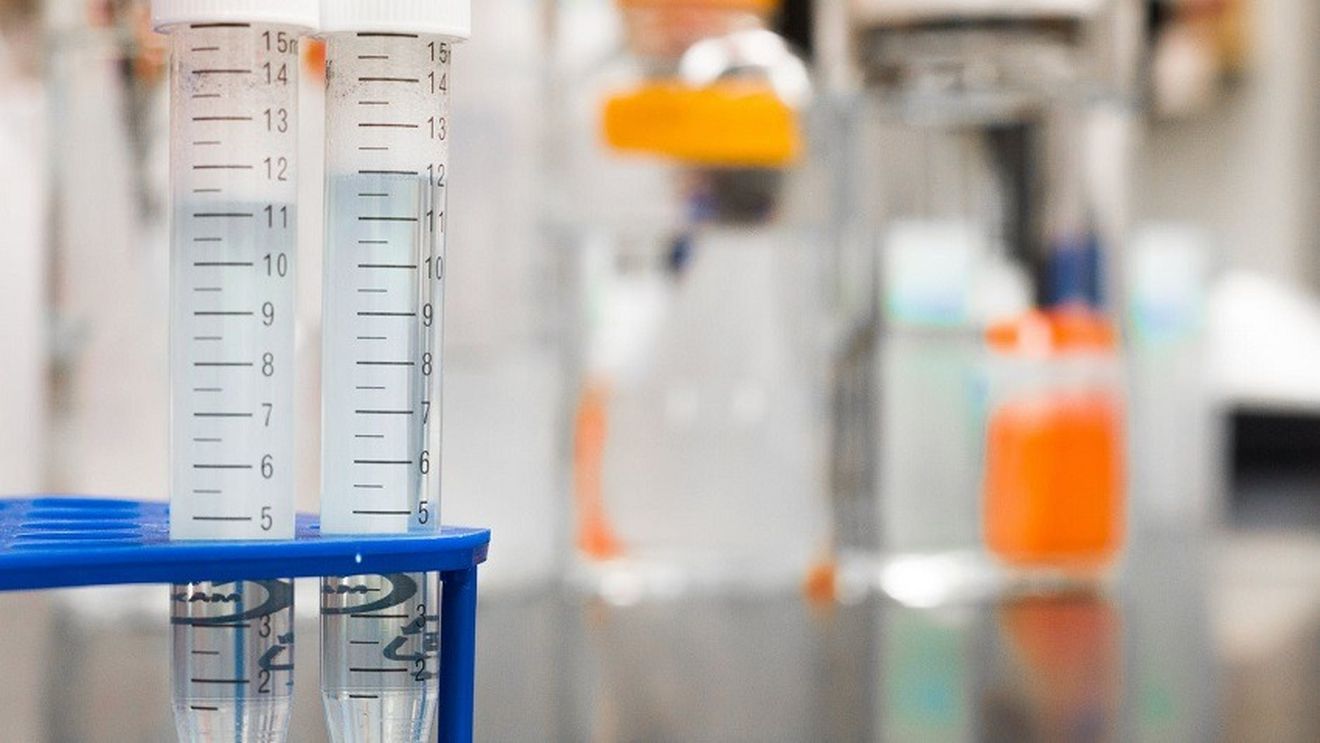 Cancerul uterin, detectat cu ajutorul unui simplu test urinar, într-un studiu britanic
