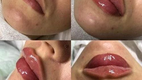 O cosmeticiană care se dădea drept medic estetician a fost prinsă de polițiști și acuzată de înșelăciune. Femeia va fi dusă la audieri