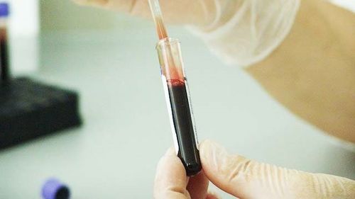 Medic epidemiolog INSP:  A fost identificat la un pacient de la Spitalul Victor Babeş vibrionul holeric non-toxigen / Doar cel toxigen este luat în considerare ca agent al holerei. În ultimii 30 de ani nu s-au înregistrat cazuri în România