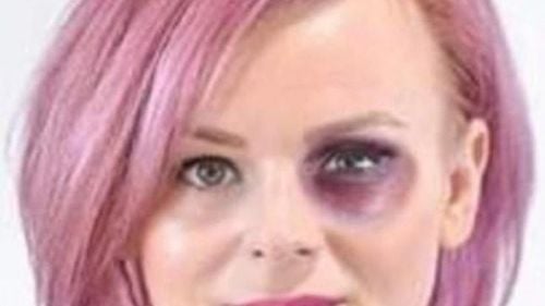 Viceprimarul USR din Brașov, Flavia Boghiu, amenințată cu bătaia de un liberal care i-a postat o imagine cu ochiul vânăt / Agresiunea, încurajată și de un dezvoltator imobiliar:„Să facem cu Boghiu ca la Mogoșoaia”