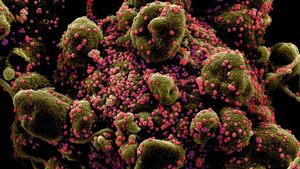 O nouă tulpină de Coronavirus detectată pentru prima dată în Brazilia a fost identificată acum și în Marea Britanie. Șase persoane infectate