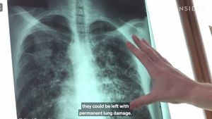 VIDEO Ce se întâmplă în corpul tău după infectarea cu coronaviurs. Evoluția bolii pe zile