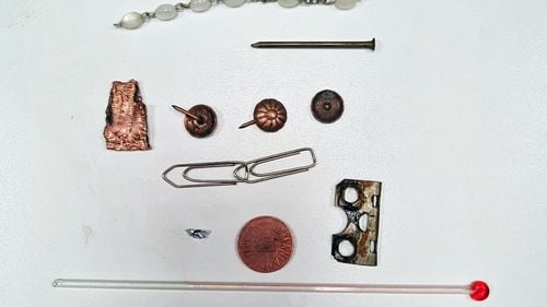 Bărbat din Vatra Dornei operat de urgență după ce a înghițit trei piuneze, un cui, două agrafe, o brățară, o balama și un termometru cu mercur