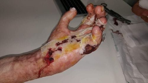 Supraviețuitorii de la Colectiv, scrisoare deschisă către Dăncilă și Pintea: Vă solicităm să ne asigurați sprijin pe viață, prin plata tuturor tratamentelor, intervențiilor chirurgicale, procedurilor de recuperare, în străinătate și în țară