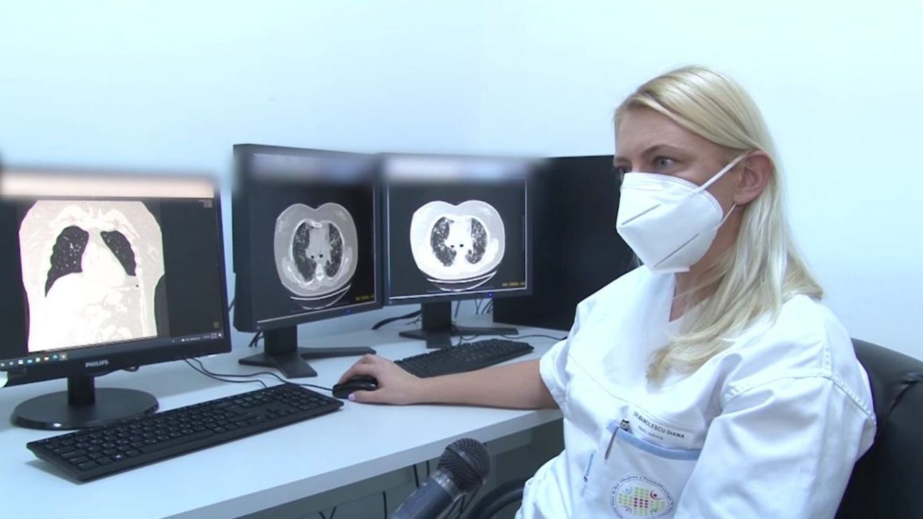 Medicii de la Spitalul „Victor Babeş” din Timişoara anunţă o explozie a cazurilor de varicelă / Majoritatea pacienților au dezvoltat o formă uşoară care nu a necesitat internare
