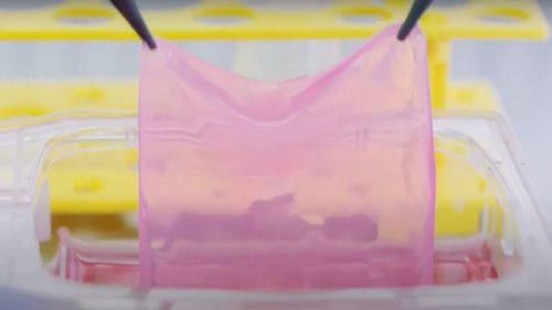 VIDEO Elveţia a dezvoltat primul aparat care produce piele pentru transplanturi