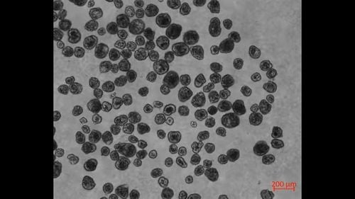 VIDEO Roboți vii minusculi realizați din celule umane îi surprind pe oamenii de știință