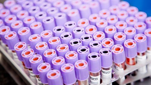 670 de infectări cu tulpina britanică, 4 cu varianta sud-africană și 2 cu cea braziliană au fost depistate în România