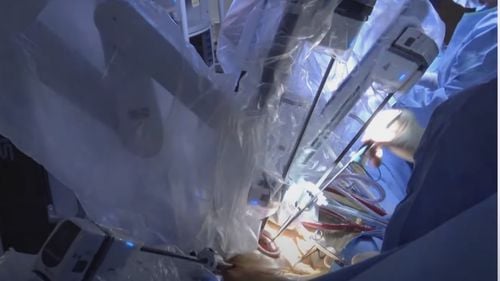 Transplant pulmonar cu ajutorul unui robot cu patru brațe, la spitalul Vall d'Hebron din Barcelona