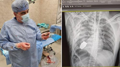 Ucraina: Medicii militari au scos o grenadă neexplodată din corpul unui soldat