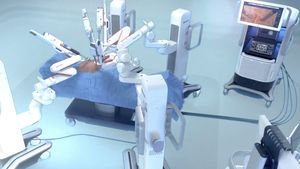 Maternitatea Odobescu din Timișoara, prima intervenţie chirurgicală asistată robotic cu ajutorul noului sistem Medtronic Hugo, la o femeie de 31 de ani cu cancer de col uterin în stadiu avansat