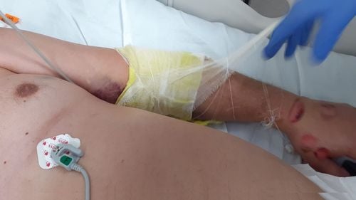 Acuzații grave: Pacienții cu COVID din secția de terapie intensiva a Spitalului Județean Sibiu sunt legați de paturi, sedați și intubați chiar și când nu este nevoie pentru liniștea medicilor și asistentelor