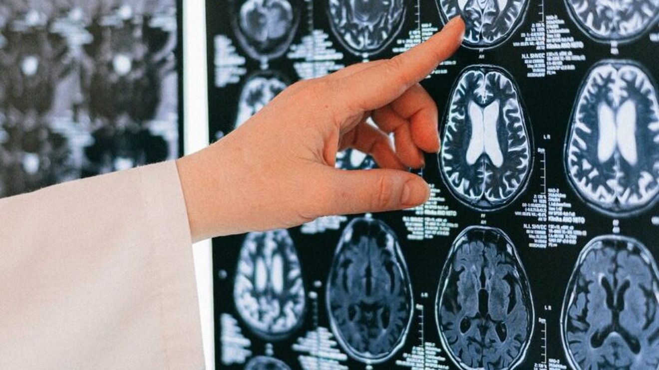 Leziunile la cap, inclusiv comoțiile, pot provoca modificări cerebrale permanente, a stabilit un nou studiu