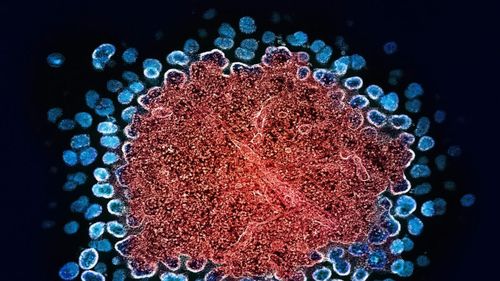 Cum cercetarea privind virusul HIV a remodelat medicina modernă: De la noi medicamente la tehnici de cercetare și cunoștințe esențiale pentru tratarea altor condiții