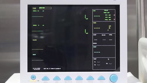 Dispozitivele medicale chinezeşti, inclusiv monitorul popular Contec CMS8000, sub atenţia autorităţilor americane din cauza riscurilor cibernetice