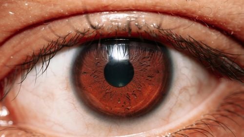 Un implant ocular a redat vederea la pacienţi cu degenerescenţă maculară legată de vârstă