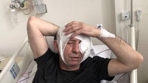 Jurnalist turc bătut în fața casei sale după o emisiune de televiziune la care a criticat administrația Erdogan
