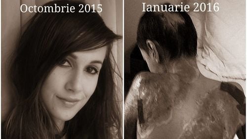 Mesajul cutremurător al unei rănite de la Colectiv după incendiul de la Sitalul din Piatra Neamț. Alexandra Furnea: Tot corupția i-a incendiat și pe ei