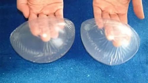 Implanturi mamare defecte: Două mii de femei din Franța au fost despăgubite pentru calitatea proastă a silicoanelor