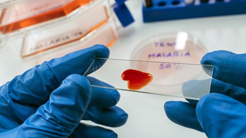 Caz de malarie confirmat în Bucureşti / Bărbatul de 69 de ani nu ar fi călătorit recent