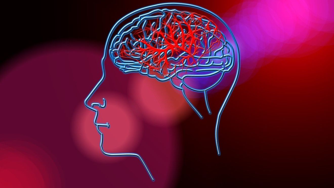 Studiu: Cazurile de accident vascular cerebral au crescut cu 70% în ultimii 30 de ani / Valurile de căldură, poluarea și excesul de greutate printre principalele cauze