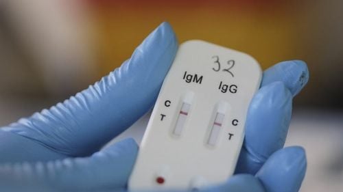 Cine scapă de autoizolarea de 14 zile la intrarea în Austria: Cetățenii care au certificat în engleză sau germană de test negativ, cei care doar tranzitează Austria și transportatorii de marfă