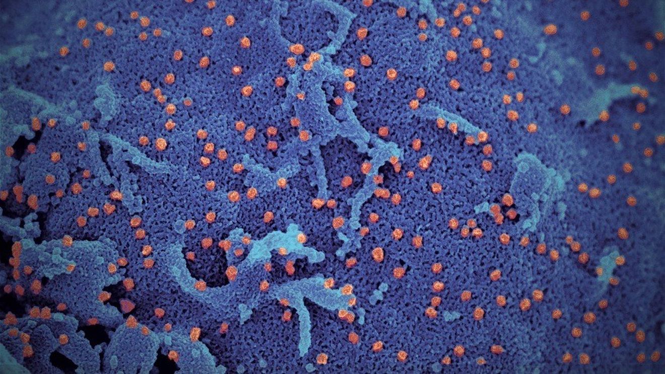 Regiunea Catalonia din Spania anunță primul caz de infectare cu coronavirus