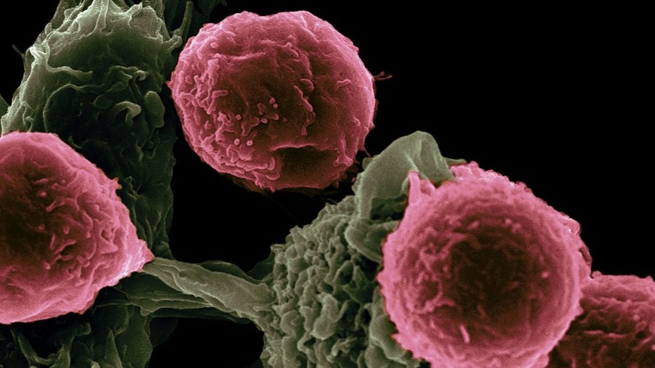 Bolile infecțioase ar putea fi prevenite datorită unui grup de proteine din sistemul imunitar al omului, arată un studiu al unei universități din Australia
