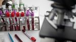 Un test de sânge ar putea prezice dacă adulții sănătoși sunt predispuși la Alzheimer