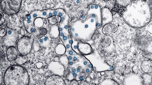 Cercetători spanioli au creat un nanomaterial care elimină coronavirusul şi ar putea fi utilizat la măştile sanitare