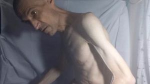 Imagini cu un deţinut iranian emaciat stârnesc indignare, după ce a slăbit 52 de kg / Medicul Farhad Meysami, în vârstă de 53 de ani, e închis din 2018, iar din 7 octombrie 2022 se află în greva foamei