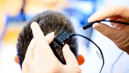 VIDEO După 18 ani de paralizie, o femeie își recâștigă vocea cu ajutorul unui implant cerebral cu inteligență artificială