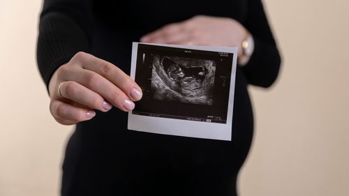 Mortalitatea infantilă crește în statele americane în care avortul este interzis, potrivit unui studiu
