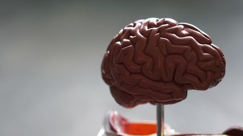 Cercetătorii au descoperit cauza progresiei bolii Alzheimer, după studierea a 400 de mostre de creier prelevate după moartea bolnavilor