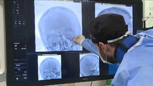 Pastila care triplează riscul de accident vascular cerebral subit la femeile tinere. Ultimele studii prezentate la Helsinki