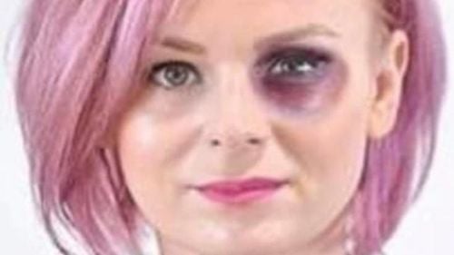 Cătălin Drulă și Clotilde Armand reacționează după ce viceprimarul din Brașov, Flavia Boghiu, a fost photoshopată cu un ochi învinețit: Băieții râd acum gros între ei, „îi stă bine rozul peste tot hahaha”