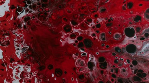 Societatea Română de Hematologie vrea să reorganizeze rețeaua națională de diagnostic și tratament al hemofiliei și altor tulburări de coagulare a sângelui