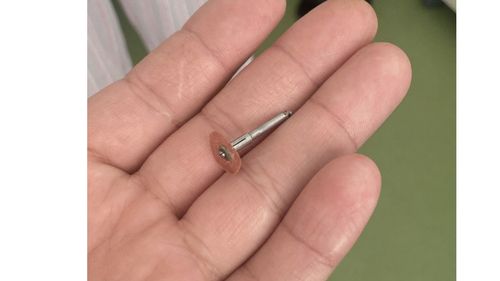 Un dentist din Iași a scăpat în gura unui copil de 5 ani un dispozitiv metalic, iar acesta l-a înghițit / „Ce vă agitați, n-a murit!” / Au dat în judecată clinica, solicitând despăgubiri în valoare de 15.000 de euro
