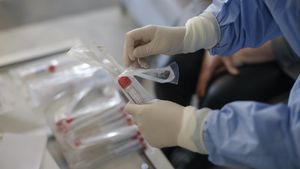 Ministrul Sănătății: la Cluj se pot face o mie de testări pe zi, pentru depistarea coronavirusului