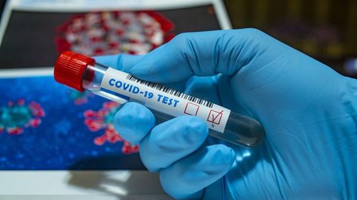 UPDATE: 1.756 de cazuri noi și 18 decese după peste 29.000 de teste. S-au dublat cazurile față de ultima raportare