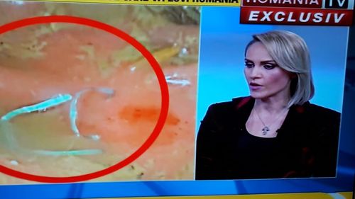 FOTO Firea a prezentat fotografiile cu sârma găsită în intestin