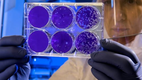 STUDIU Beneficiarii transplantelor de celule stem hematopoietice nu ar avea un risc mai mare de a dezvolta cancer/ Au fost analizate date de la pacienți care au primit transplanturi în urmă cu aproape cinci decenii