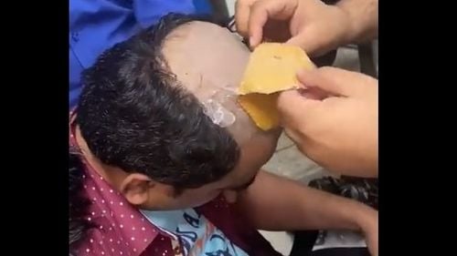 Un bărbat a fost arestat după ce a încercat să treacă prin aeroportul din New Delhi cu aur în valoare de 40 de mii de dolari ascuns sub perucă / Avea alte două pungi cu aur ascunse în rect