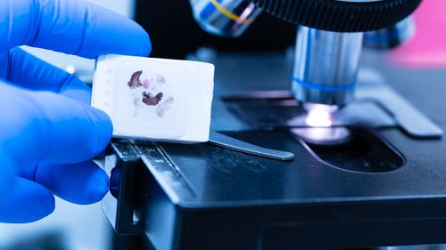 #MediciBuni Dr. Horațiu Mureșan, OncoTeam: „Nu există boli, ci pacienți. De oricât de multă tehnologie am putea dispune, intervenția umană e indispensabilă pentru înțelegerea datelor și stabilirea diagnosticului pentru fiecare pacient în parte”