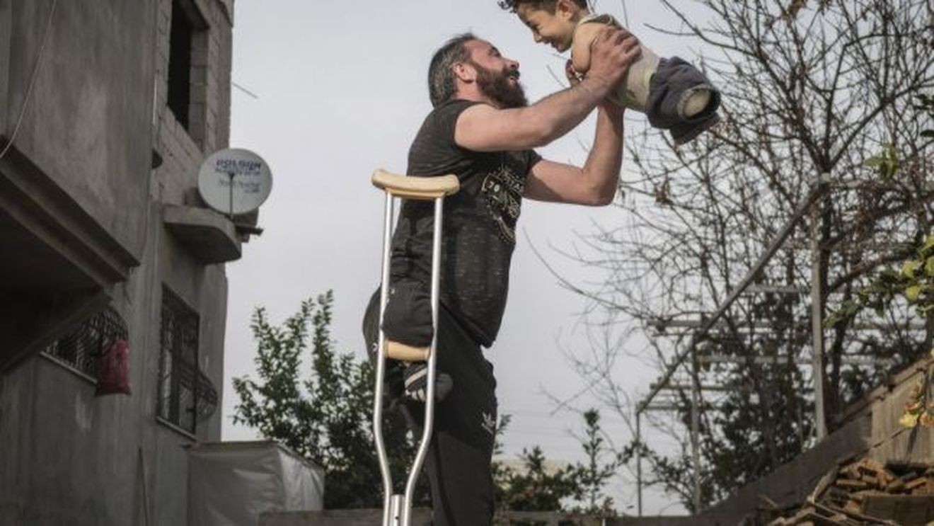 O fotografie cu un tată ridicându-şi fiul născut fără mâini şi picioare spre cer, ambii supraviețuitori ai războiului din Siria, a emoţionat Italia