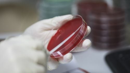 Cercetare privind COVID-19: Comisia Europeană finanțează încă un proiect pentru dezvoltarea unui diagnostic rapid. România e prezentă, ca partener, într-un singur proiect de cercetare din cele 18 finanțate european