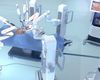 Maternitatea Odobescu din Timișoara, prima intervenţie chirurgicală asistată robotic cu ajutorul noului sistem Medtronic Hugo, la o femeie de 31 de ani cu cancer de col uterin în stadiu avansat